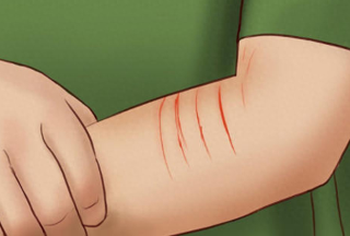 小猫挠没出血但蹭破点皮（小猫挠没出血但蹭破点皮有一点红）