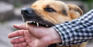 狂犬病潜伏期最长多长时间发作（狂犬病潜伏期多长时间发病）