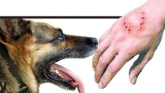 狂犬病潜伏期多长时间场达20年（狂犬病潜伏期20年?）