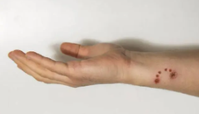 猫咬得狂犬病几乎为0（猫抓得狂犬病几乎为0）