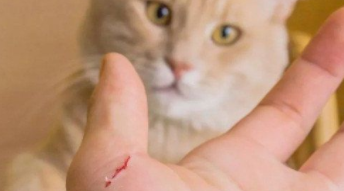 被猫抓了一下轻微破皮要打针吗没出血（被猫抓了一下轻微破皮要打针吗没出血 猫打了狂犬疫苗）
