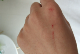 2个月幼猫轻微抓破皮（2个月幼猫轻微抓破皮怎么处理）