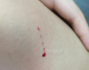 被猫抓了一下轻微破皮要打针吗猫打了疫苗（被猫抓了一下轻微破皮要打针吗 猫打过疫苗）