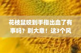 花枝鼠咬到手指出血了有事吗？别大意！这3个风险必须警惕